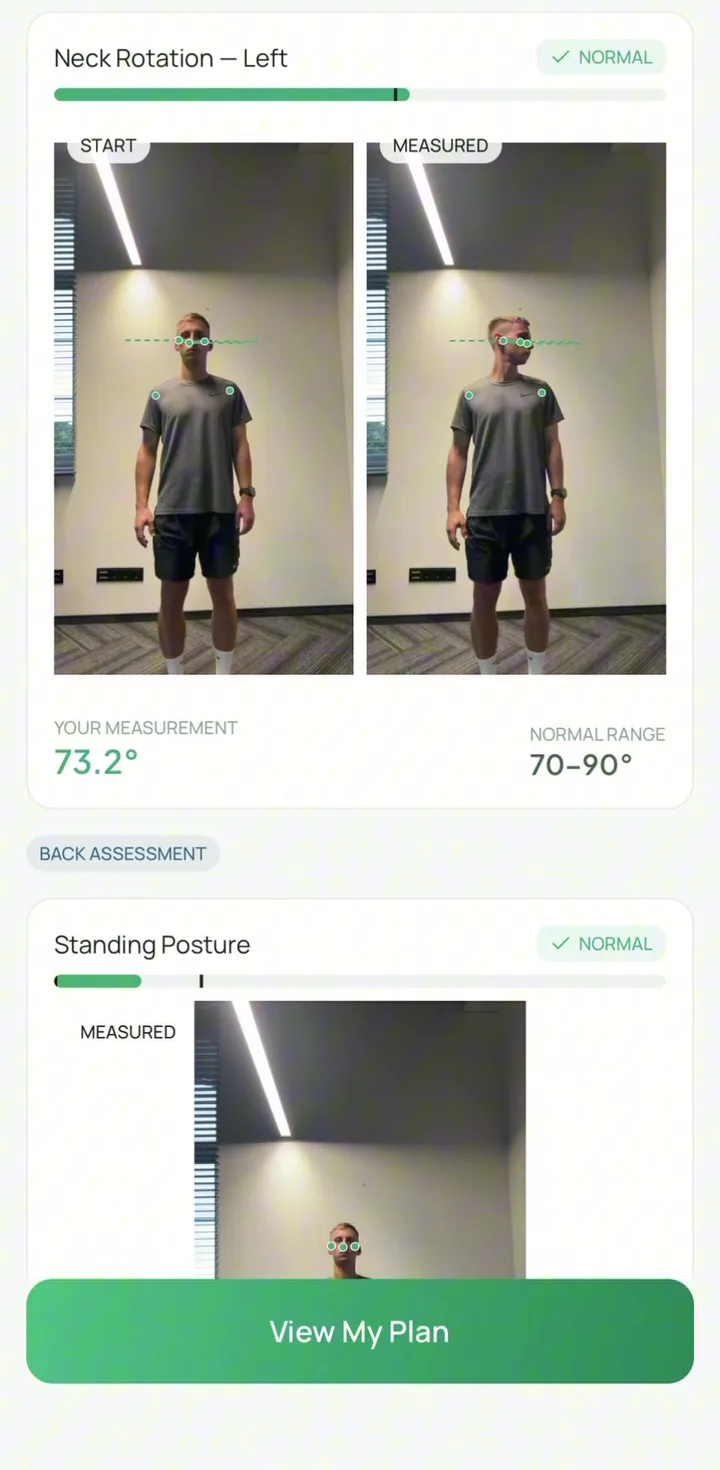 Neck rotation re-measured at 73.2 degrees, back inside the 70–90 degree normal range
